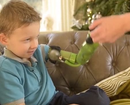 Un brazo con tecnología robótica le permite abrazar por vez primera a su hermano